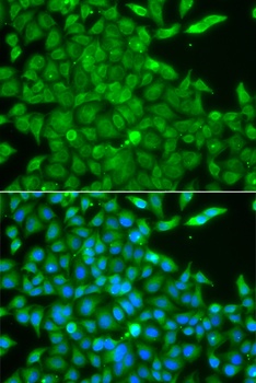 CSNK1G2 Antibody