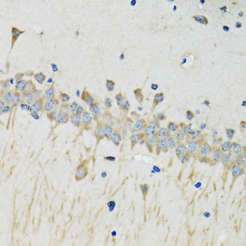SERPINA4 Antibody