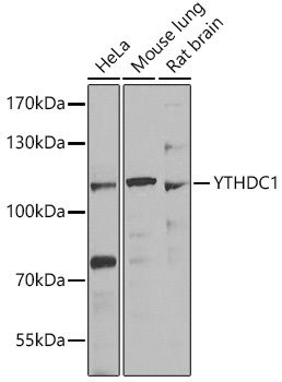 YTHDC1 Antibody