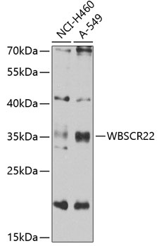 WBSCR22 Antibody