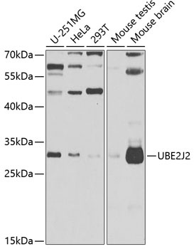 UBE2J2 Antibody