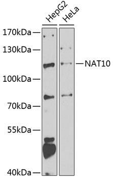 NAT10 Antibody
