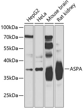 ASPA Antibody