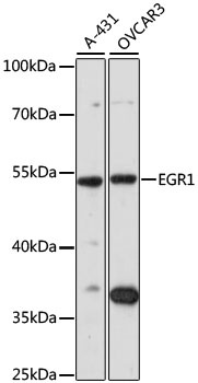 EGR1 Antibody