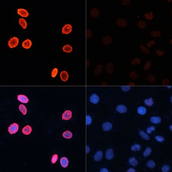 H3K56ac Antibody