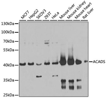 ACADS Antibody