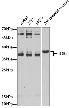 TOB2 Antibody