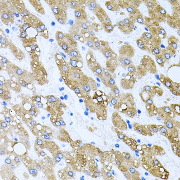 TOB2 Antibody