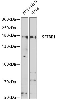 SETBP1 Antibody