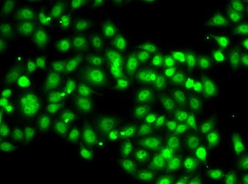 SETBP1 Antibody