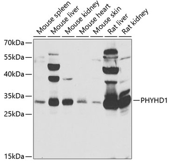 PHYHD1 Antibody