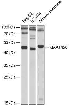 KIAA1456 Antibody