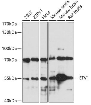 ETV1 Antibody