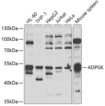 ADPGK Antibody