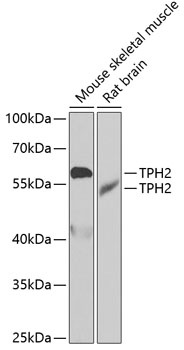TPH2 Antibody