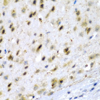 TPH2 Antibody