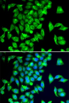 TPH2 Antibody
