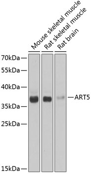 ART5 Antibody