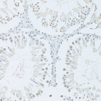 FIP1L1 Antibody