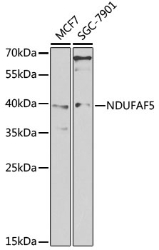NDUFAF5 Antibody
