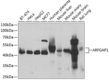 ARFGAP1 Antibody