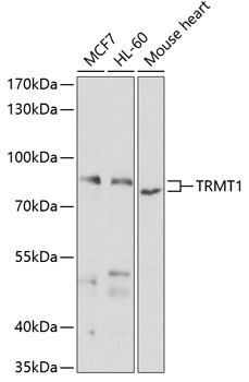 TRMT1 Antibody