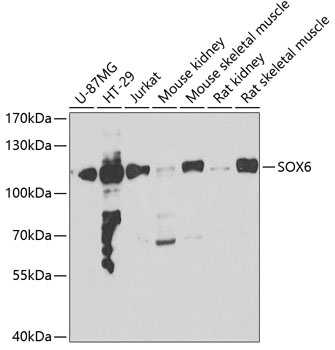 SOX6 Antibody