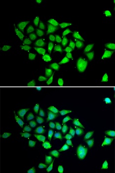DPP8 Antibody