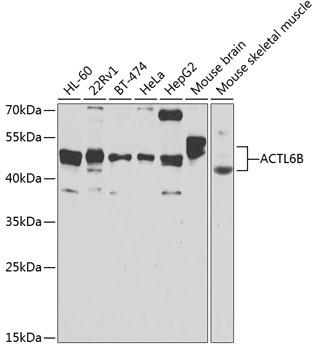 ACTL6B Antibody