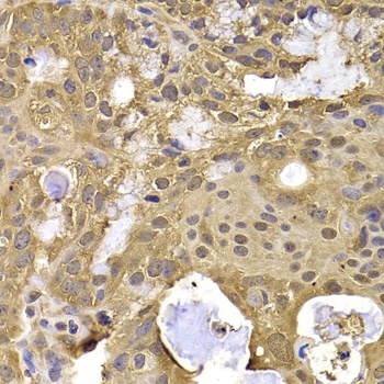 NAA20 Antibody