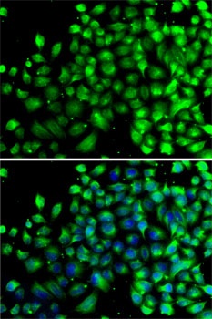 NAA20 Antibody