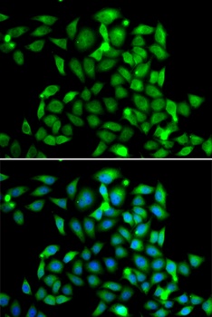 CLASP1 Antibody