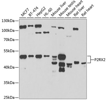 P2RX2 Antibody