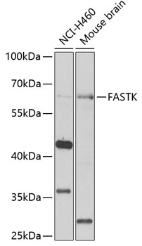 FASTK Antibody