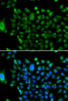 NCOR1 Antibody