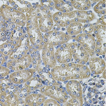 DNAJA3 Antibody