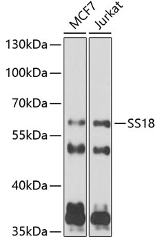 SS18 Antibody