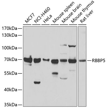 RBBP5 Antibody