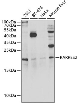 RARRES2 Antibody