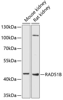 RAD51B Antibody