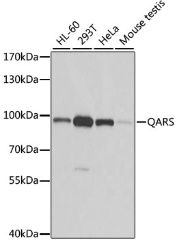 QARS Antibody