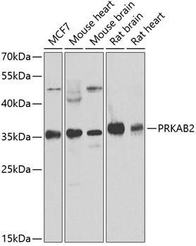 PRKAB2 Antibody