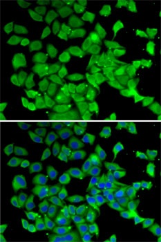 PARN Antibody