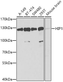 HIP1 Antibody
