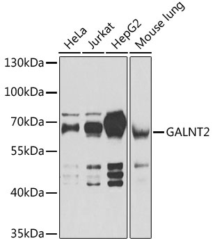 GALNT2 Antibody