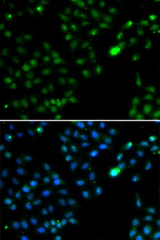 FKBP3 Antibody