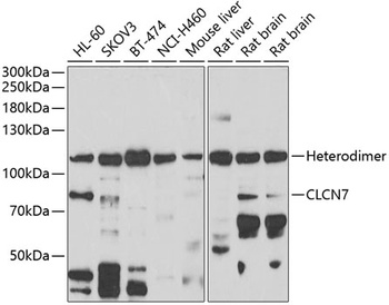 CLCN7 Antibody