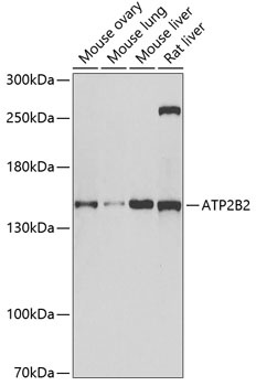 ATP2B2 Antibody