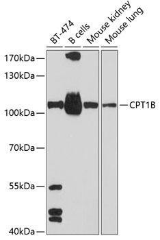 CPT1B Antibody