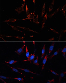 CPT1B Antibody